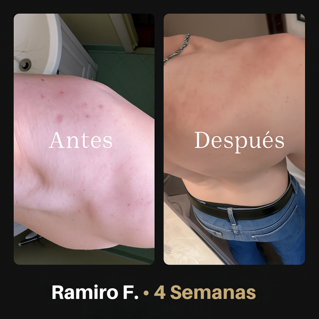 Shield Body - La solución REAL al ANCE CORPORAL